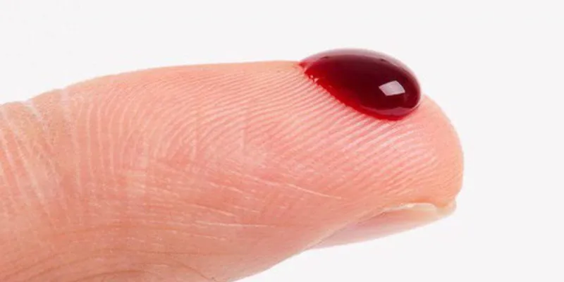 Nằm mơ thấy máu chảy đánh số gì? Khám phá ý nghĩa và con số may mắn 3 Giấc mơ thấy máu chảy từ miệng